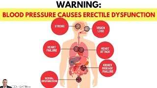 🌡WARNING How Blood Pressure Causes Erectile Dysfunction amp Impotency  by Dr Sam Robbins [upl. by Tessa]