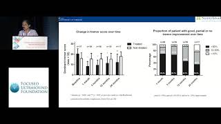 Ying Meng  MRgFUS thalamotomy for treatment of essential tremor a 2year outcome study 2018 [upl. by Bisset538]