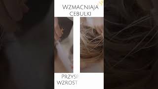 Masz dość wypadania włosów  hair [upl. by Norry]