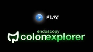 Colonscopy AE  Sigmoid Intubation  Straightening Technique [upl. by Ettecul]