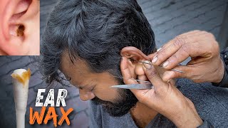 Wax Removal Inside Ear  Dirtiest Ear Cleaning on Street  Indian Street Ear Cleaner [upl. by Wallraff141]