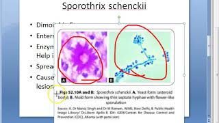 Microbiology 578 a SporoTrichosis Sporothrix schenckii Rose Gardners Asteroid body Splendore Hoeppli [upl. by Akayas]