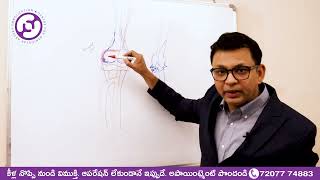 Genicular Artery Embolization for knee pain  Dr Rajah V Koppala  Avis Hospitals [upl. by Judon]