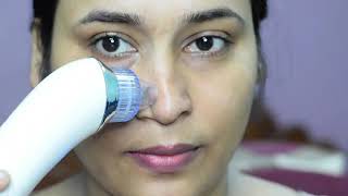 1 min blackheads amp whiteheads remove method OMG IT WORKED suction blackhead remover Review amp Demo [upl. by Ching]