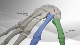 Thumb Metacarpal Arthritis Repair with Arthrex® CMC Mini TightRope® [upl. by Olympe]