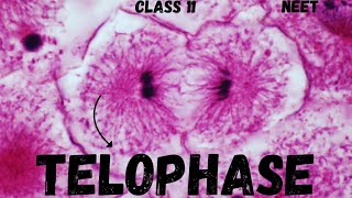 NEET CELL CYCLE AND CELL DIVISION  TELOPHASE  CLASS 11 neet ncert youtube youtubeshorts [upl. by Airbmat]