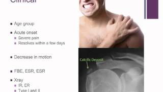 Dr Marc Friso  Calcific Tendinitis of the Shoulder [upl. by Kcor632]