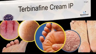 terbinafine hydrochloride creamuseside effecthow to use terbinafine cream nepali [upl. by Proudlove]