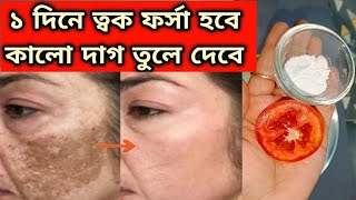 ফর্সা হবার সহজ উপায়েforsa howar sohoj upaytomato facialGlow Facial [upl. by Mailli]