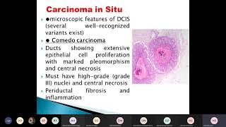 morphological types of breast cancer [upl. by Haggai745]