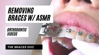 Orthodontist Removes Braces w ASMR sound  Satisfying Braces ASMR  TheBracesDoc shorts h [upl. by Atteirneh]