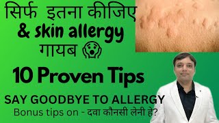 10 Tips for Skin allergy treatment at home स्किन एलर्जी को जल्दी ठीक करने की १० टिप्स Dermatologist [upl. by Yeleak]