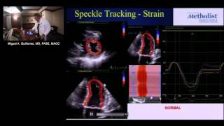 Regional Wall Motion and Stress Echocardiography Miguel Quiñones MD December 8 2016 [upl. by Hanshaw]