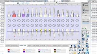 Odontograma  Newsoft DS 11 [upl. by Brnaby767]