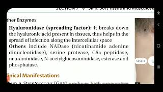 Apurba S Sastry Beta hemolytic streptococcal infections [upl. by Zacharia]