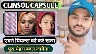 Clinsol capsule uses in hindi how to take clinsol capsule full review in hindi [upl. by Catlaina]