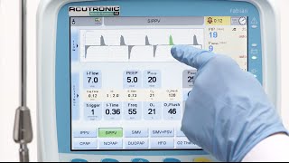 fabian HFO SIPPV Synchronised Intermittent Positive Pressure Ventilation [upl. by Leban]