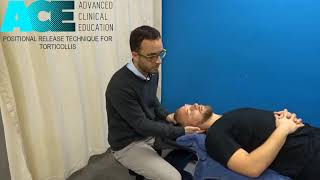 PRT Positional Release Technique Torticollis [upl. by Barbabra]