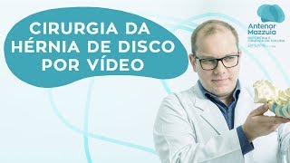 Cirurgia da hérnia de disco por vídeo [upl. by Dorthea]