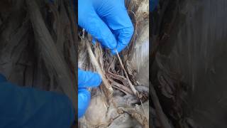 Musculocutaneous Nerve Anatomy Shorts Disection♥️Subscribe for more mbbs doctor medicaleducation [upl. by Leizo]