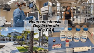 Behind the Scenes Neurosurgery with an Anesthesiologist Assistant Day in the life vlog [upl. by Aicenav]