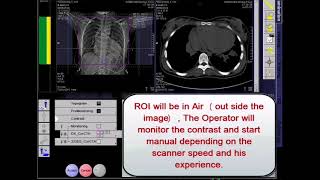 Congenital Heart Disease Protocol in CT [upl. by Gardener280]