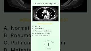 Chest Buzz 5 radiologychannel007 [upl. by Boice]