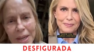 LAS SORPRENDENTES FOTOS DE CÓMO QUEDÓ CECILIA BOLOCCO DESPUÉS DE UN TRATAMIENTO FACIAL [upl. by Eilraep]