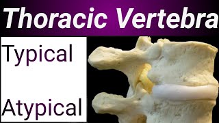 Anatomy of Thoracic Vertebrae Typical amp Atypical Thoracic Vertebrae Dr Shayzee [upl. by Nat]