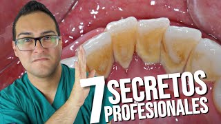 Como QUITAR el Sarro💩 de los Dientes 👅 ANTES DE QUE SALGA ¡LOS 7 SECRETOS PROFESIONALES🤓 [upl. by Nanci]