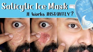 Viral Salicylic Ice Mask Review  Shadhik Azeez  Tamil  English Subtitles [upl. by Noynek974]