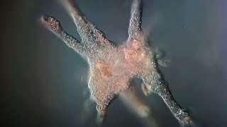 How dangerous are braineating Amoeba [upl. by Ajdan734]