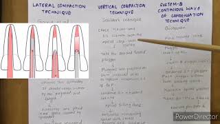 Obturation techniques in endodontics [upl. by Aztinaj]