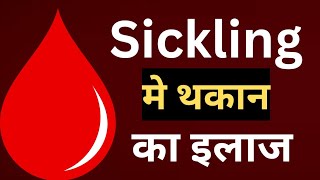 Sickling मे थकान का इलाज।Sickle cell anemia [upl. by Sidell]