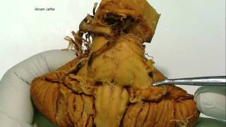 Cerebellum  gross anatomy [upl. by Naol]