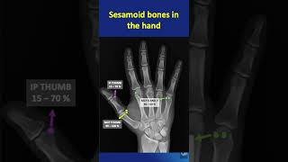 Shorts  57 Sesamoid bones in the hand  Location function and significance in less than a minute [upl. by Tiffany]