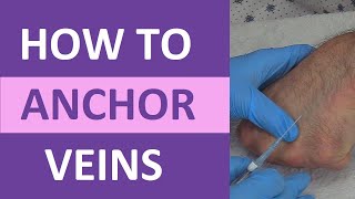 How to Anchor Veins  Venipuncture IV Therapy Blood Draw Phlebotomy Rolling Veins [upl. by Nitsirk779]