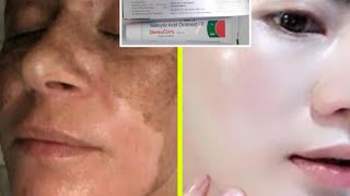 Salicylic acid cream  Remove Pigmentation  Dark spot  Acne amp Acne scars  Brijwasi Girl  India [upl. by Gilson202]