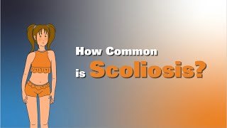 Insight into Adolescent Idiopathic Scoliosis [upl. by O'Driscoll58]