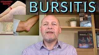 Bursitis in a Nutshell Get it better quickly [upl. by Aikehs]