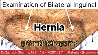 हर्निया क्या होता है Inguinal Hernia Examination in OPD😱 By DrSaurabh Sharma MS patanjali [upl. by Andi888]