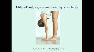 EhlersDanlos Syndrome  CRASH Medical Review Series [upl. by Aileduab895]