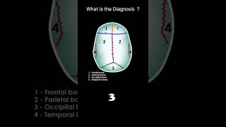 Skull bones and sutures superior view CT Brain Anatomy Skull bones Quiz 4radiologychannel007 [upl. by Bradly]