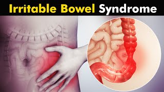 What Happens in Irritable Bowel Syndrome IBS  Symptoms Causes and Treatment UrduHindi [upl. by Ueik]