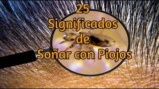 25 Significados de Soñar con Piojos [upl. by Aieka716]