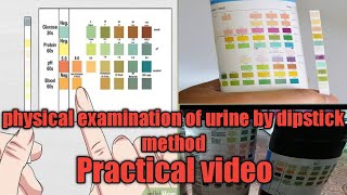 Examination of Urine BY DIPSTICK method  Urine test करना सीखें [upl. by Esylle]