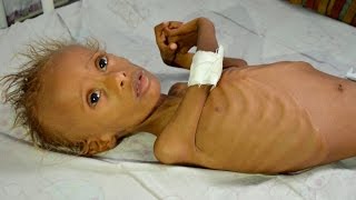 Genocide In Yemen Media Complicit In USSaudi War Crimes [upl. by Jillian]