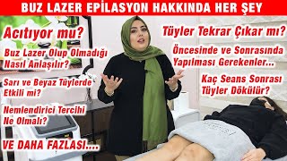 BUZ LAZER EPİLASYON Acıtıyor mu Tüyler Tekrar Çıkar mı Dikkat Edilmesi Gerekenler [upl. by Bobbye]