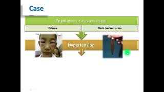 Acute Poststreptococcal Glomerulonephritis  APSGN [upl. by Cath]