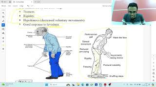 Diseases of the extra pyramidal system [upl. by Marcy466]